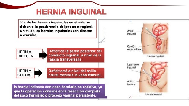 Hernia Inguinal Pedi trica